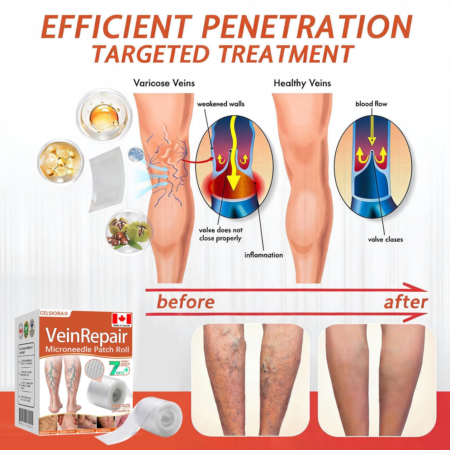 🍁 ✨Final Hours! Save 75% on Celsiora® Vein Ease Microneedle Care Patch(For Spider Veins, Varicose Veins, Swelling & Leg Fatigue)