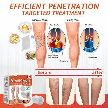 🍁 ✨Final Hours! Save 75% on Celsiora® Vein Ease Microneedle Care Patch(For Spider Veins, Varicose Veins, Swelling & Leg Fatigue)