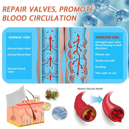 🍁 ✨Final Hours! Save 75% on Celsiora® Vein Ease Microneedle Care Patch(For Spider Veins, Varicose Veins, Swelling & Leg Fatigue)