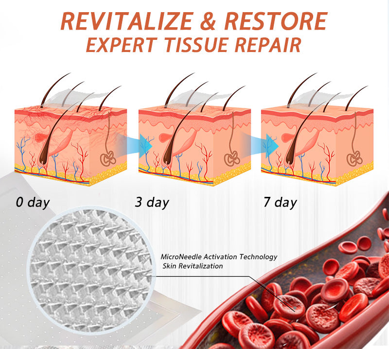 🍁 ✨Final Hours! Save 75% on Celsiora® Vein Ease Microneedle Care Patch(For Spider Veins, Varicose Veins, Swelling & Leg Fatigue)
